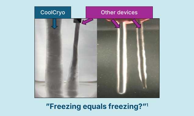 Freezing CoolCryo vs competition