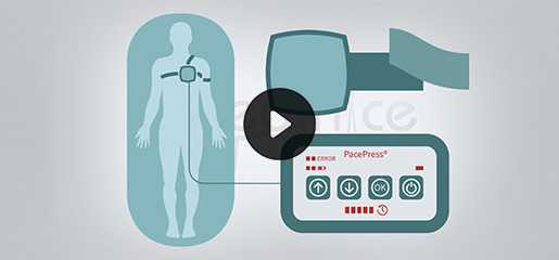 Medinice PacePress video